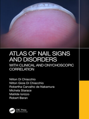 cover image of Atlas of Nail Signs and Disorders with Clinical and Onychoscopic Correlation